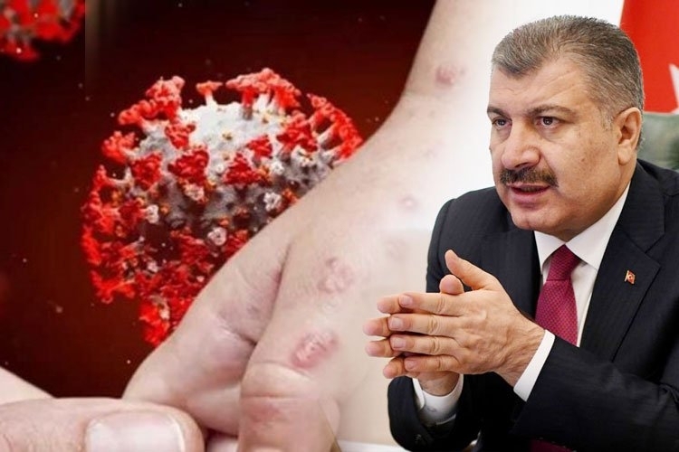 Eris Varyantı Türkiye'de Tespit Edildi